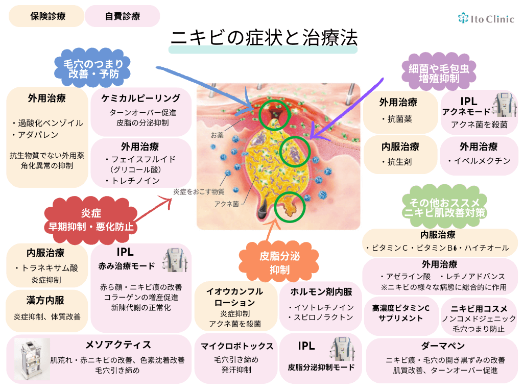 ニキビの治療法